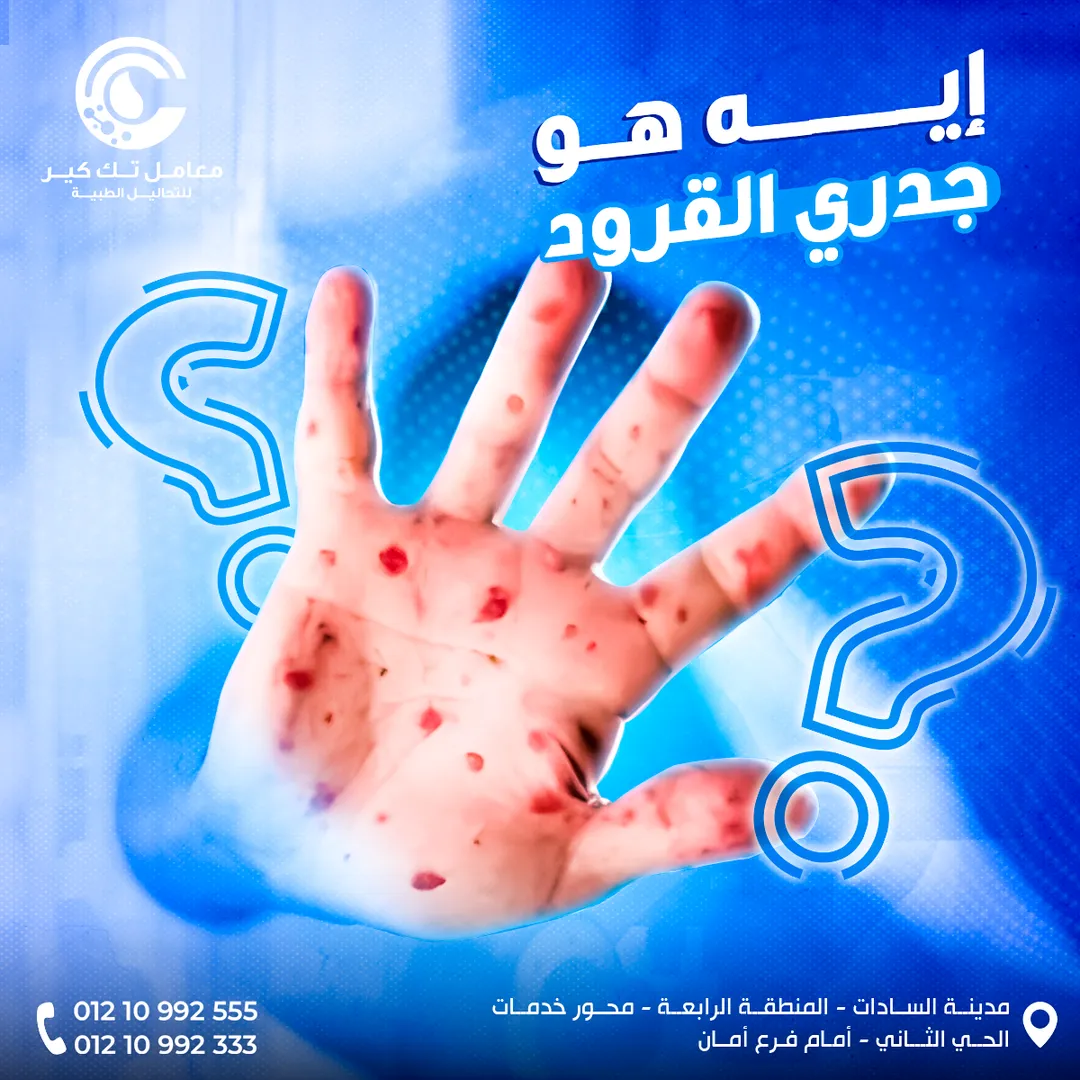 معامل تك كير — المحتوى — 20